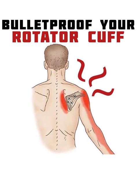 Slap Tear Rehab Shoulder Labrum Injury Exercises Education Artofit