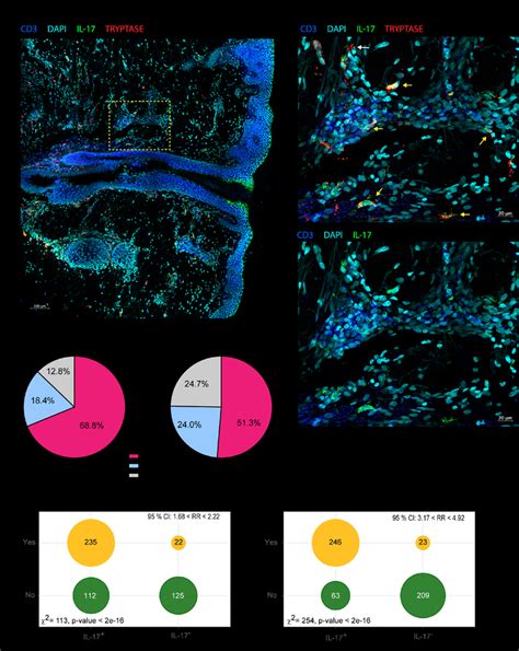 Mast cells are the main cells staining IL-17 + in the early stages of... | Download Scientific ...