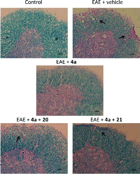 Myelin In The White Matter Of Mice Spinal Cord Luxol Fast Blue