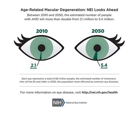 Age Related Macular Degeneration Infographic Between 2010 Flickr