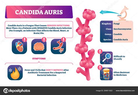 Ilustración vectorial de Candida auris Explicación de infección por