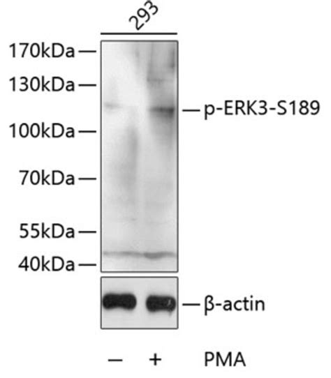 Anti Phospho ERK3 S189 Antibody Produced In Rabbit