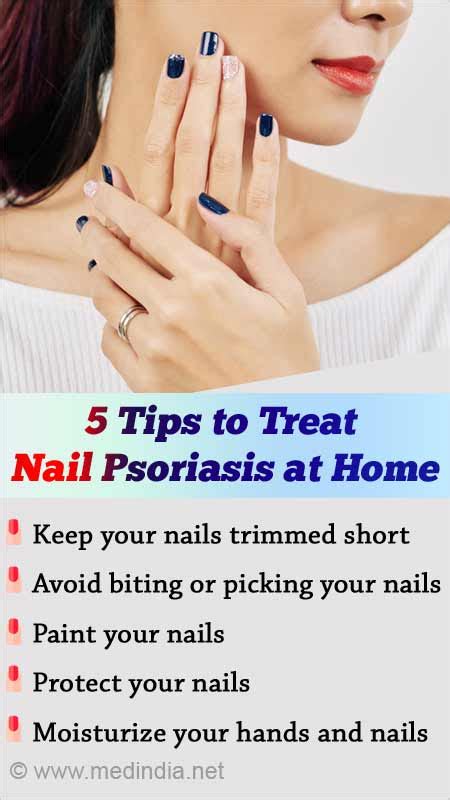 Psoriasis Nails Home Remedy - Nail Ftempo