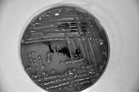 Mucous Lactose Positive Colonies Of Klebsiella Pneumoniae On Macconkey