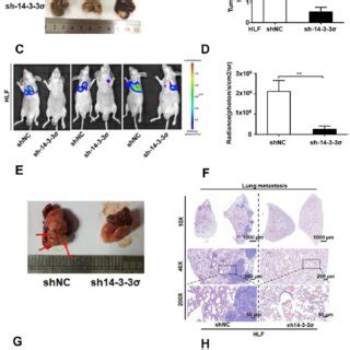 Silencing the 14 3 3σ inhibited HCC growth and lung metastasis in vivo