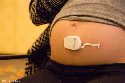 This Wearable Device Helps Pregnant Women Track Their Bundles Of Joy