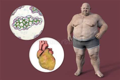 Molecule Of Cholesterol And Obese Heart In Overweight Man 3d Illustration Concept Of Obesity