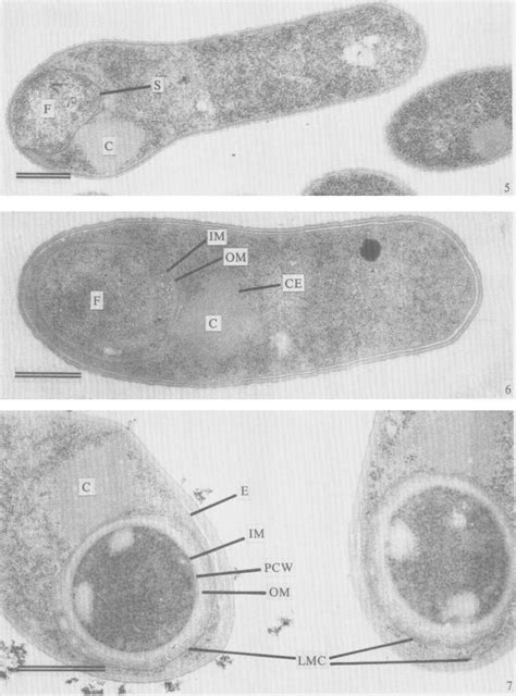 Cells At F Beginning Of Spore Coat And Exosporium Synthesis