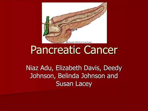 Ppt Pancreatic Cancer Powerpoint Presentation Free Download Id2690107