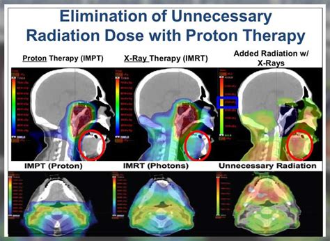 Proton Therapy: What Works - Engiomed : Medical Equipment Trading L.L.C.