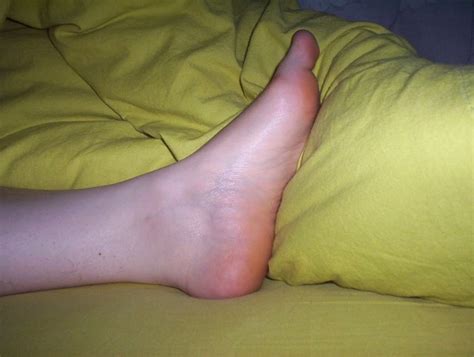 Anna Shows Her Toes Pictures I Took 7 Nude Pics XHamster