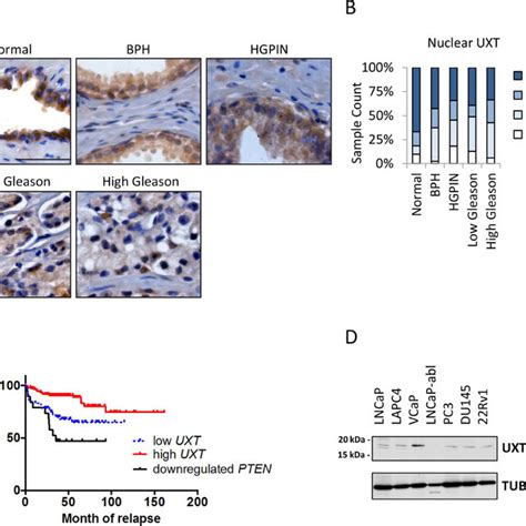 Uxt Ablation In The Mouse Prostate Resulted In Pin Different Mouse