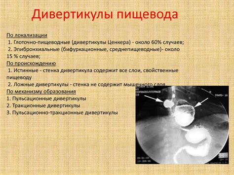 Лучевая диагностика органов ЖКТ - презентация онлайн