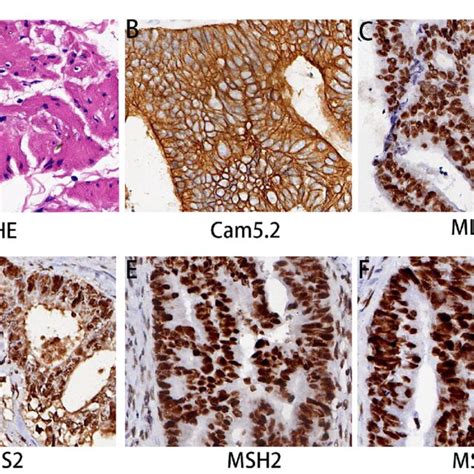 Histopathological Findings Of Rectal Mass A He Staining Revealed Download Scientific Diagram