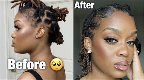 How To Regrow Your Edges Bald Spots And Thinning Hair YouTube