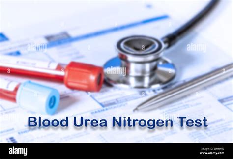 Blood Urea Nitrogen Test Testing Medical Concept Checkup List Medical