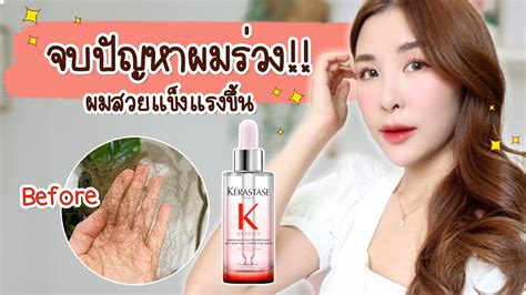 จบปญหาผมขาดหลดรวง ดวยเซรม Kerastase Genesis Anti Hair Fall