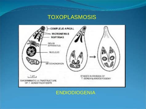 Toxoplasmosis