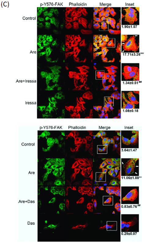 Gefitinib And Dasatinib Reversed Arecoline Induced A549 Cell Migration