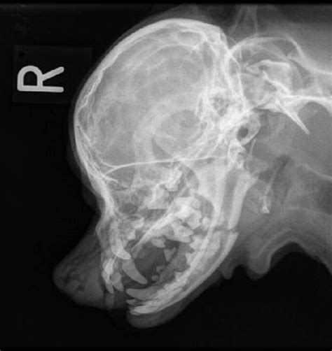 Preoperative lateral oblique radiograph of the patient's left mandible ...