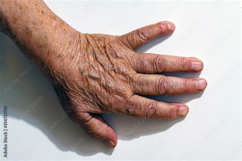 The process of aging of human skin - wrinkled hands of a very old man ...