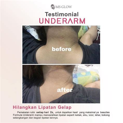 Jual Underarm Ms Glow Shopee Indonesia