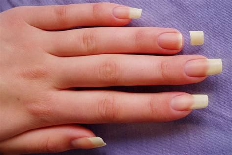 How To Take Care Of Broken Nails | Caring For Broken And Brittle Nails