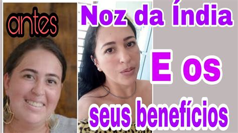 Saiba dos excelentes benefícios que a noz da Índia tem emagrecer