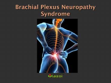 PPT – Brachial Plexus Neuropathy Syndrome: Symptoms, causes, diagnosis ...