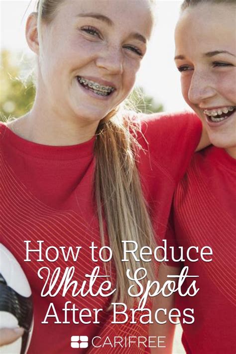 How To Reduce White Spots After Braces Carifree After Braces Teeth