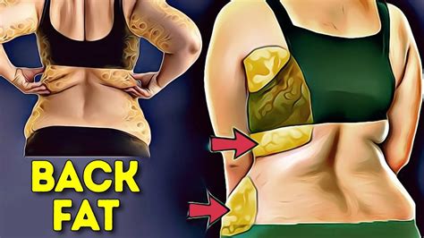 Back Fat Bra Bulge Do This Only Workout For Days In Back