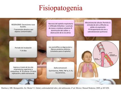 Bronquiolitis Y Laringotraque Tis Crup Ppt Descarga Gratuita