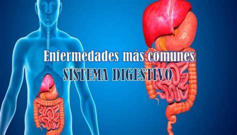 Enfermedades Mas Comunes Del Sistema Digestivo Ara Blog