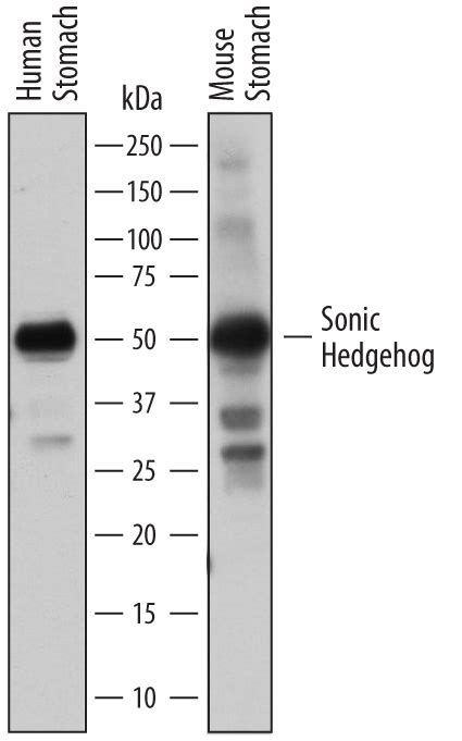 Human Mouse Sonic Hedgehog Shh NTerminus Antibody AF464 Bio Techne