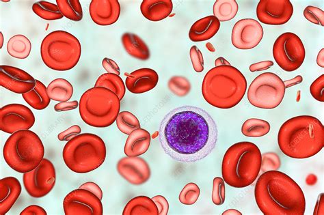 Blood After Hemotransfusion For Anaemia Illustration Stock Image