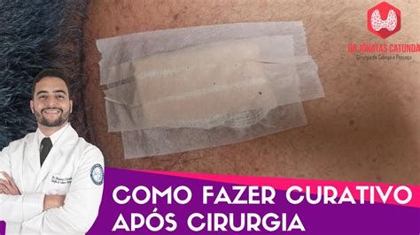 Como Fazer Curativo Ap S Uma Cirurgia Youtube