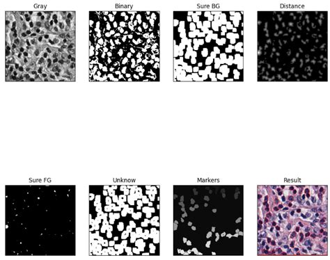 Computer Vision How To Improve Performance Of Cell Segmentation Using