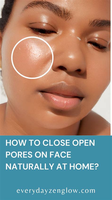 How To Close Open Pores On Face Naturally At Home In 2024 Open Pores