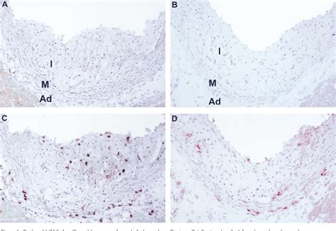 PDF The Effects Of Total Lymphocyte Deficiency On The Extent Of