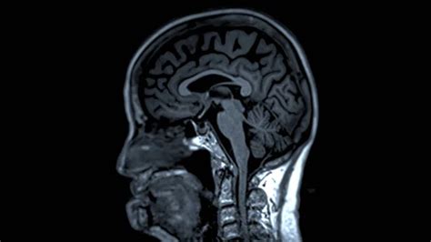 Mri back scan Stock Photos, Royalty Free Mri back scan Images ...