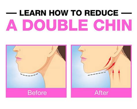 Learn How To Reduce A Double Chin Project Next