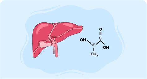 Lactic Acidosis Guide Essential Insights For Healthcare Pros Medtigo