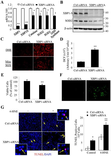 Human Rpe Arpe 19 Cells Were Transfected With Xbp1 Sirna Or Control