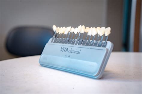 Teeth Whitening - Missouri City, TX, Richmond, TX, Rosenberg, TX ...