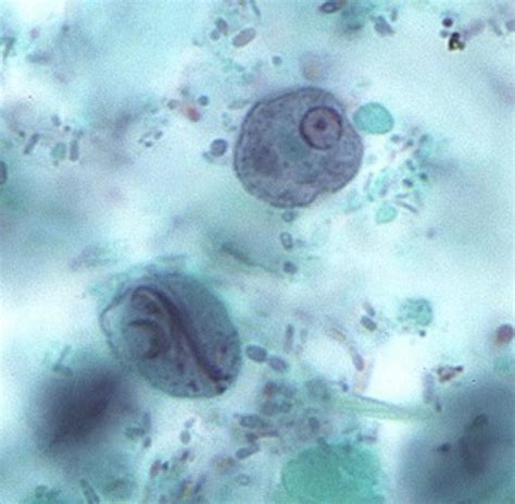 Mayo Clinic Infectious Diseases On Twitter 2 Intestinal Protozoa Co Infection This Photo