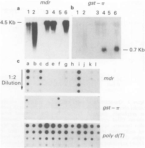 Expression Of Mdrl And Gst R In Cell Lines And Tumour Biopsies A