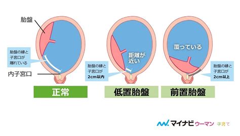 コンプリート！ 妊娠 子宮の位置 177289 妊娠 子宮の位置 変化