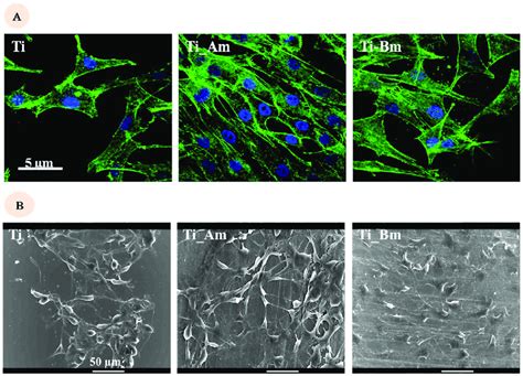 Analysis Of Cytoskeleton Distribution And Cell Morphology On Titanium