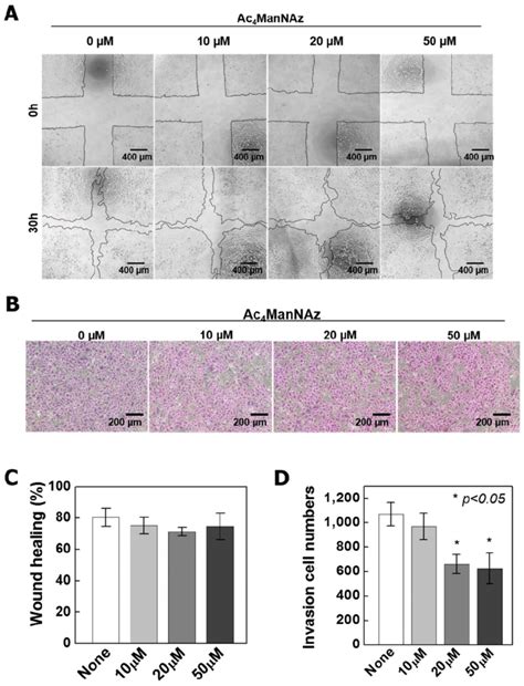 Wound Healing And Invasion Assay On Ac4mannaz Treated A549 Cells A