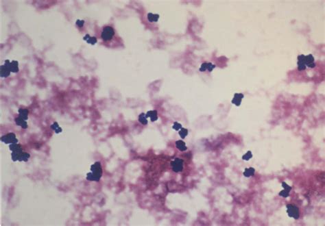 Bakteri Staphylococcus Epidermidis Homecare24